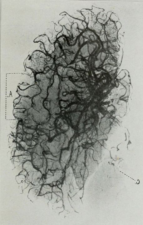APOSITO COSMOPOR LF 7,2X6CM 5 UDES ANTIBACTER