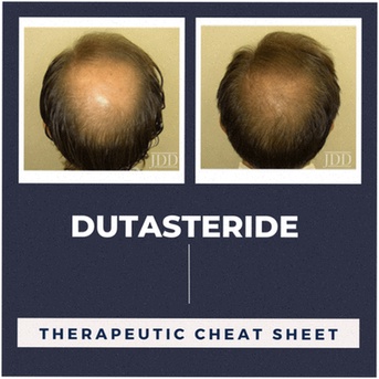 Comprar Dutasteride genérico precio